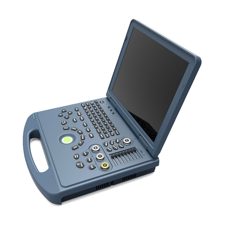 4D Colour Doppler Ultrasound 