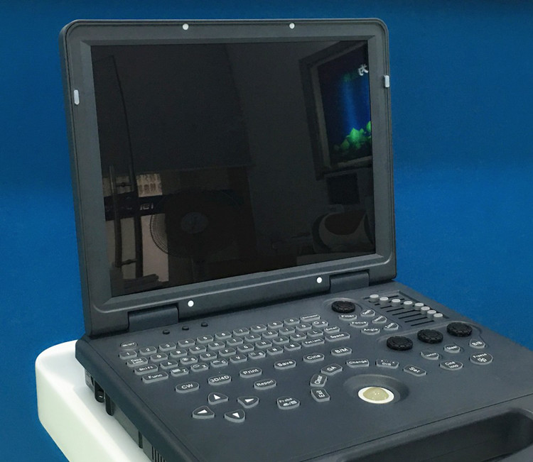 4D Colour Doppler Ultrasound 