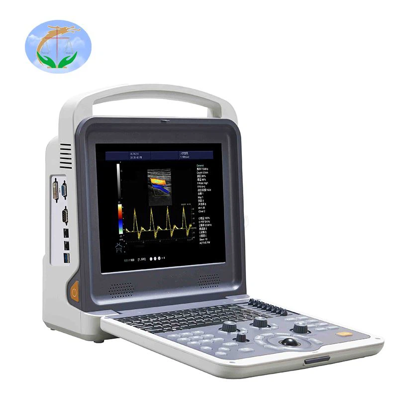 Color Doppler Ultrasound Color Doppler Ultrasound