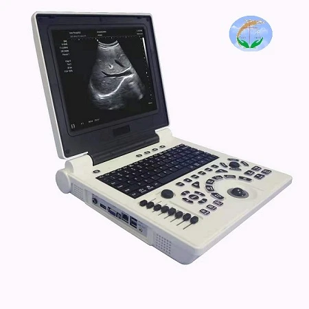 3D color doppler ultrasound scanner