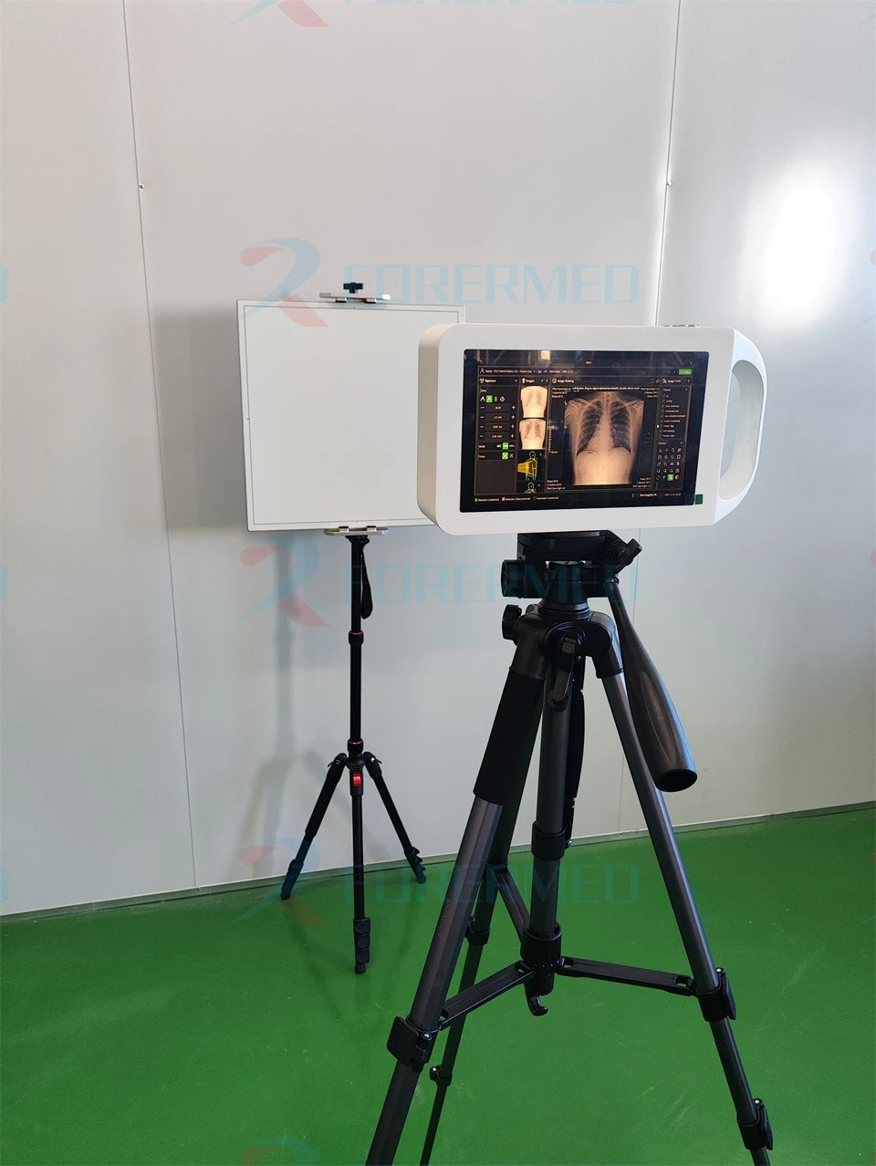 Handheld X Ray Scanner Price