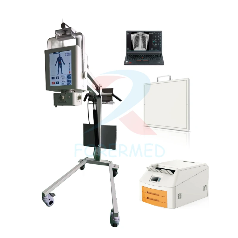 Mobile Digital X Ray Machine Price best