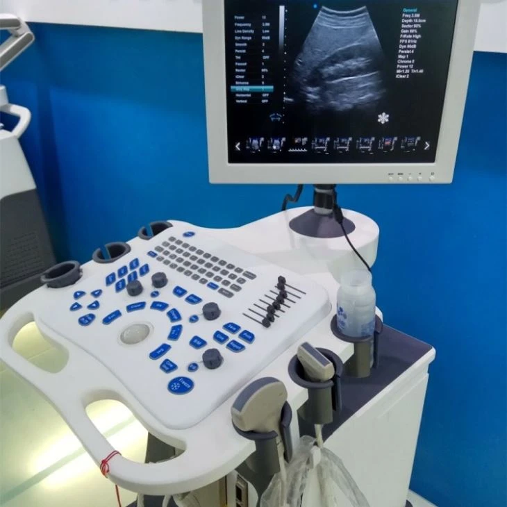 3D Color Digital Trolley Ultrasound Scanner