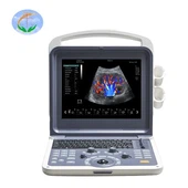 4D کودک قابل حمل پزشکی رنگ داپلر دستگاه سونوگرافی