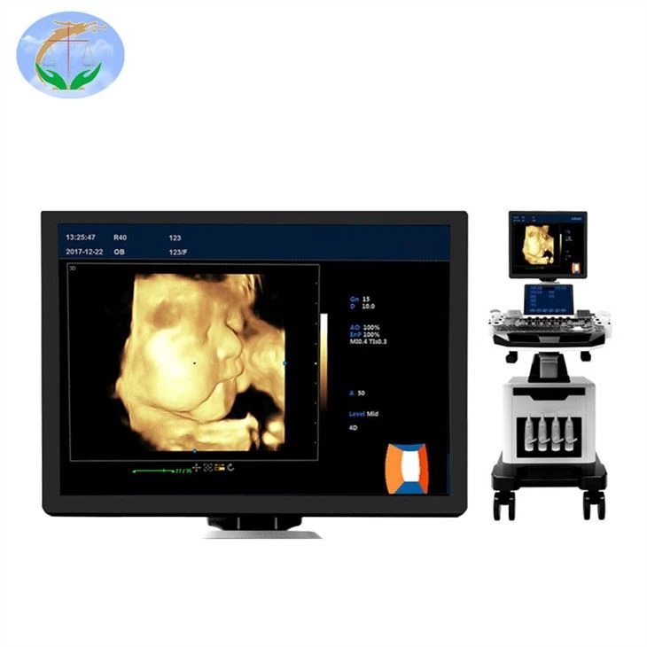 3D-4D-Color Doppler-Ultrasound Machine-screen