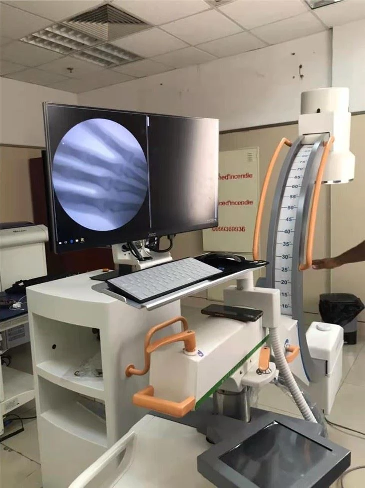 Digital C Arm X-ray Machine
